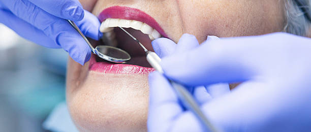 Best Emergency Root Canal Therapy in Holland, MI